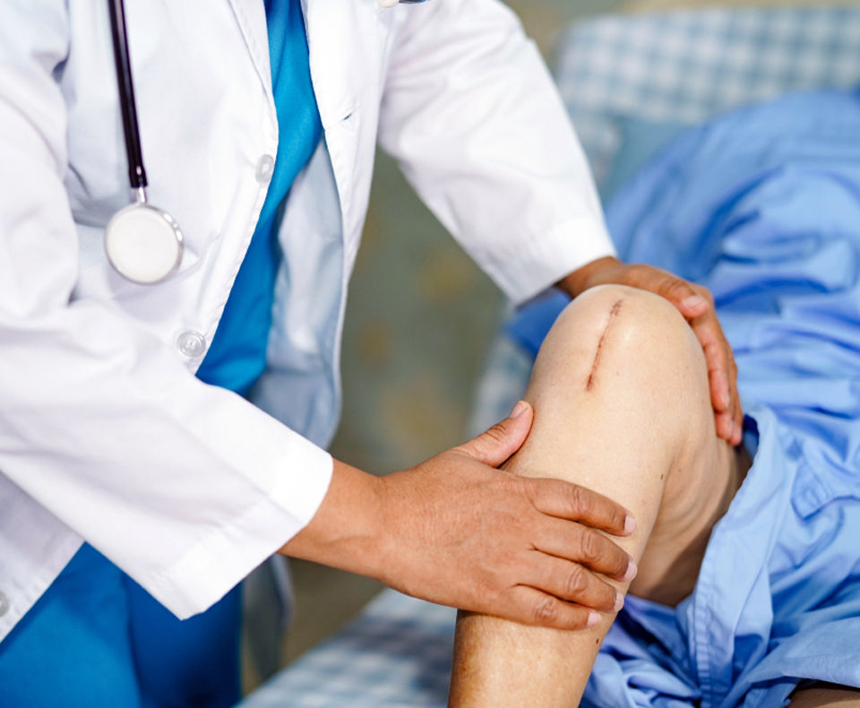 Joint Replacement_img2